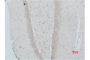 Immunohistochemical analysis of paraffin-embedded Rat Brain Tissue using NMBR Polyclonal Antibody.