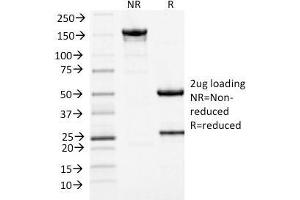 SDS-PAGE Analysis Purified MCM7 Mouse Monoclonal Antibody (MCM7/1467).