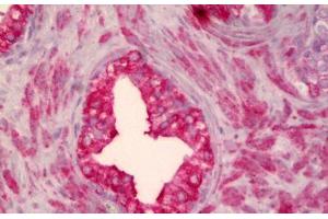 Anti-SMO antibody IHC staining of human prostate. (SMO anticorps)