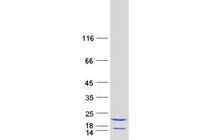 Validation with Western Blot