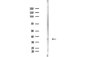 anti-G Protein-Coupled Receptor 62 (GPR62) (C-Term) antibody