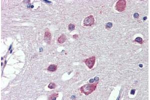 Brain, cortex, Human: Formalin-Fixed, Paraffin-Embedded (FFPE)