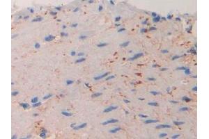 Detection of IL11Ra in Mouse Small intestine Tissue using Polyclonal Antibody to Interleukin 11 Receptor Alpha (IL11Ra) (IL11RA anticorps  (AA 59-217))