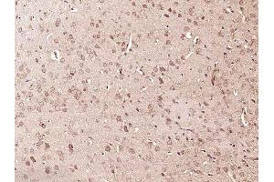 Paraformaldehyde-fixed, paraffin embedded rat brain, Antigen retrieval by boiling in sodium citrate buffer (pH6) for 15min, Block endogenous peroxidase by 3% hydrogen peroxide for 30 minutes, Blocking buffer (normal goat serum) at 37°C for 20min, Antibody incubation with RPS6KA1(Thr348) Polyclonal Antibody  at 1:400 overnight at 4°C, followed by a conjugated secondary and DAB staining.