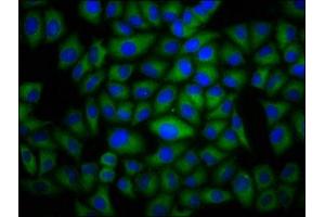 Immunofluorescence staining of Hela cells with ABIN7150914 at 1:100, counter-stained with DAPI. (Dysferlin anticorps  (AA 105-278))
