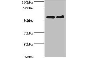Western blot All lanes: CDK16 antibody at 5 μg/mL Lane 1: Mouse brain tissue Lane 2: Mouse small intestine tissue Secondary Goat polyclonal to rabbit IgG at 1/10000 dilution Predicted band size: 56, 64, 57 kDa Observed band size: 56 kDa (CDK16 anticorps  (AA 277-496))