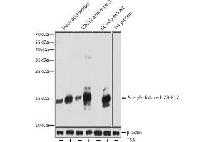 Western blot analysis of extracts of various cell lines, using Acetyl-Histone H2B-K12 antibody (ABIN7267731) at 1:1000 dilution. (Histone H2B anticorps  (acLys12))