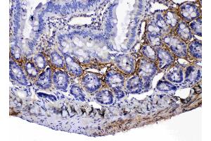 IHC analysis of Periostin using anti-Periostin antibody .
