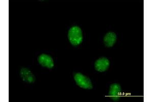 Immunofluorescence of purified MaxPab antibody to IFRD1 on HeLa cell.