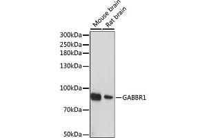 Western blot analysis of extracts of various cell lines, using G antibody (ABIN6131686, ABIN6140882, ABIN6140883 and ABIN6214785) at 1:1000 dilution. (GABBR1 anticorps  (AA 200-460))