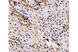 Immunohistochemistry of paraffin-embedded Rat kidney using BCHE Polyclonal Antibody at dilution of 1:100 (40x lens). (Butyrylcholinesterase anticorps)