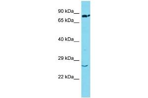 Host: Rabbit Target Name: SSX2 Sample Type: Lung Tumor lysates Antibody Dilution: 1. (SSX2 anticorps  (Middle Region))