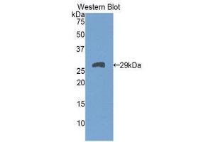 Western Blotting (WB) image for anti-Slow Skeletal Troponin T (TNNT1) (AA 1-228) antibody (ABIN1860819) (TNNT1 anticorps  (AA 1-228))