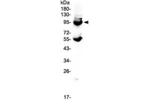 Western blot testing of mouse lung tissue lysate with CD105 antibody at 0. (Endoglin anticorps)