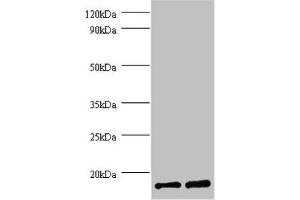 Western blot All lanes: FKBP1A antibody at 2 μg/mL Lane 1: EC109 whole cell lysate Lane 2: 293T whole cell lysate Secondary Goat polyclonal to rabbit IgG at 1/15000 dilution Predicted band size: 12 kDa Observed band size: 12 kDa (FKBP1A anticorps  (AA 2-103))