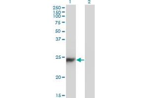 Western Blot analysis of CBX5 expression in transfected 293T cell line by CBX5 monoclonal antibody (M01), clone 1E11-3A10.