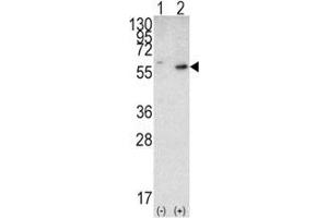 Western blot analysis of PTEN antibody and 293 cell lysate (2 ug/lane) either nontransfected (Lane 1) or transiently transfected with the PTEN gene (2).