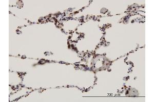 Immunoperoxidase of monoclonal antibody to FBXW7 on formalin-fixed paraffin-embedded human lung. (FBXW7 anticorps  (AA 599-707))