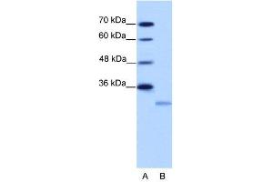 WB Suggested Anti-EIF4E2  Antibody Titration: 2. (EIF4E2 anticorps  (N-Term))