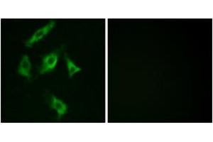 Immunofluorescence analysis of COS7 cells, using Stathmin 1 (Ab-15) Antibody. (Stathmin 1 anticorps  (AA 5-54))