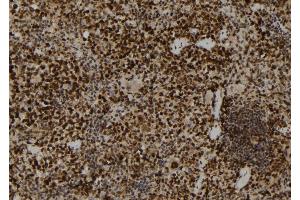 ABIN6272859 at 1/100 staining Mouse spleen tissue by IHC-P. (PADI2 anticorps  (Internal Region))