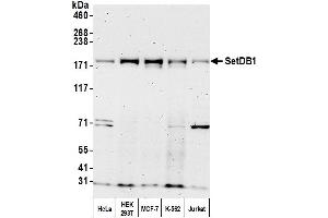 anti-SET Domain, Bifurcated 1 (SETDB1) (AA 1125-1175) antibody