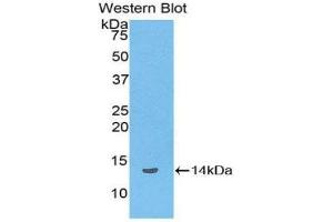Western Blotting (WB) image for anti-Lipotropin, beta - (AA 179-267) antibody (ABIN1858144) (Lipotropin, beta - (AA 179-267) anticorps)