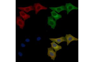 TCIRG1 Mouse Monoclonal Antibody staining Hela cells by IF/ICC.