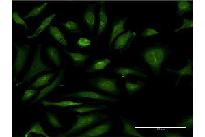 Immunofluorescence of monoclonal antibody to CSAD on HeLa cell.