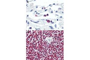 Immunohistochemical (Formalin/PFA-fixed paraffin-embedded sections) staining in human neutrophils (A) and human spleen (B) with LGR6 polyclonal antibody . (LGR6 anticorps  (Internal Region))