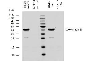 anti-Keratin 18 (KRT18) antibody