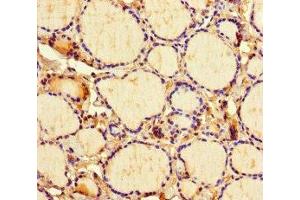 Immunohistochemistry of paraffin-embedded human thyroid tissue using ABIN7158468 at dilution of 1:100 (ICE1 (AA 1213-1505) anticorps)