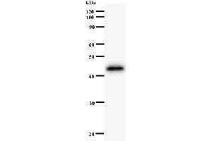 Western Blotting (WB) image for anti-Zinc Finger Protein 384 (ZNF384) antibody (ABIN931115) (ZNF384 anticorps)