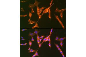 Immunofluorescence analysis of NIH-3T3 cells using Cation-independent Cation-independent M6PR (IGF2R) (IGF2R) Rabbit mAb (ABIN1678848, ABIN3018066, ABIN3018067 and ABIN7101574) at dilution of 1:100 (40x lens). (IGF2R anticorps)