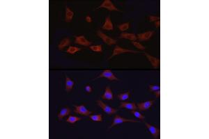 Immunofluorescence analysis of NIH/3T3 cells using  Rabbit pAb (ABIN3020671, ABIN3020672, ABIN1512605 and ABIN6213659) at dilution of 1:100 (40x lens).