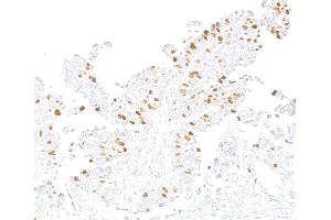 Immunohistochemistry (IHC) image for anti-Forkhead Box M1 (FOXM1) (AA 650-700) antibody (ABIN7795806)