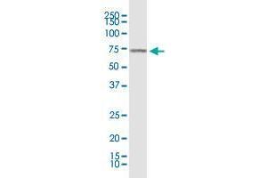 KLF11 monoclonal antibody (M03), clone 10D8. (KLF11 anticorps  (AA 404-512))