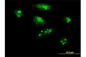 Immunofluorescence of purified MaxPab antibody to MKI67IP on HeLa cell. (NIFK anticorps  (AA 1-293))