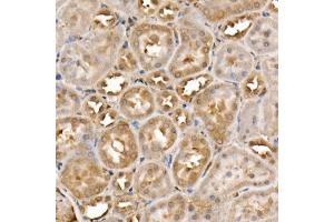 Immunohistochemistry of paraffin-embedded rat kidney using TNK2 Rabbit pAb (ABIN3016189, ABIN3016190, ABIN3016191, ABIN1683072 and ABIN6219613) at dilution of 1:50 (40x lens). (TNK2 anticorps  (AA 70-385))