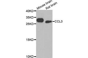 Western blot analysis of extracts of mouse brain and rat brain cell lines, using CCL3 antibody.