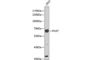 Western blot analysis of extracts of 293T cells, using P antibody (ABIN6132463, ABIN6145262, ABIN6145264 and ABIN6216484) at 1:1000 dilution. (PAX7 anticorps  (AA 289-518))