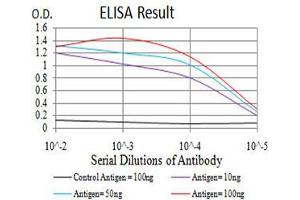 Black line: Control Antigen (100 ng), Purple line: Antigen(10 ng), Blue line: Antigen (50 ng), Red line: Antigen (100 ng),