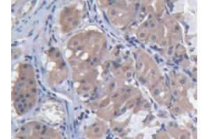 DAB staining on IHC-P; Samples: Human Stomach Tissue