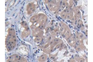 DAB staining on IHC-P; Samples: Human Stomach Tissue (MARS anticorps  (AA 74-198))