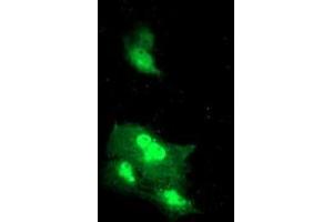 Anti-DTNB mouse monoclonal antibody (ABIN2455578) immunofluorescent staining of COS7 cells transiently transfected by pCMV6-ENTRY DTNB (RC203798). (Dystrobrevin beta anticorps)