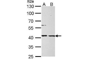 WB Image MPI antibody detects MPI protein by Western blot analysis.