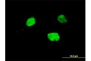 Immunofluorescence of monoclonal antibody to IRX5 on HeLa cell. (IRX5 anticorps  (AA 204-264))
