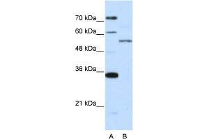 WB Suggested Anti-ZNF707 Antibody Titration:  0. (ZNF707 anticorps  (N-Term))