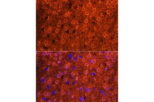 Immunofluorescence analysis of mouse brain using CDK6 antibody (ABIN7266595) at dilution of 1:100. (CDK6 anticorps  (AA 1-326))