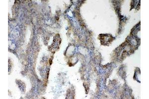 IHC analysis of PAH using anti-PAH antibody .